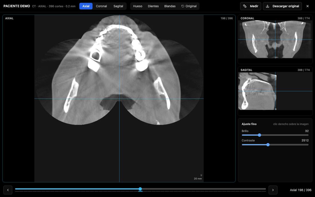 Visor DICOM de NUXIA con cortes axial, coronal y sagital